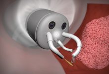 Robot Endotheranostics tumori del retto