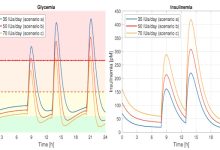 Traiettorie glicemia e insulinemia diabate di tipo 1