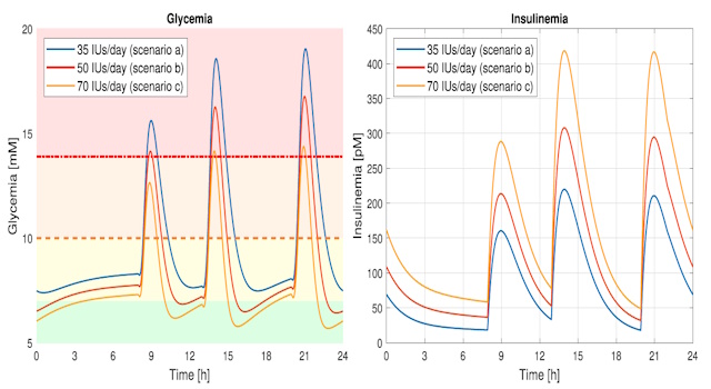 Traiettorie glicemia e insulinemia diabate di tipo 1