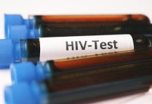 centri test Hiv epatiti sifilide