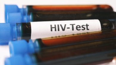 centri test Hiv epatiti sifilide