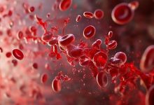 Sangue-cordonale-Ospedale Infantile Regina Margherita