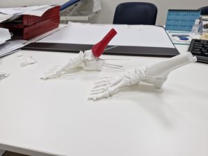 asl biella tornare a camminare