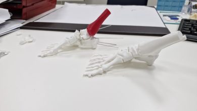 asl biella tornare a camminare