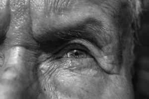 Glaucoma pseudoesfoliativo